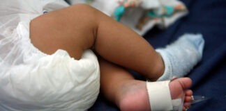 Guerrero informa su primera muerte por sarampión; víctima es un bebé