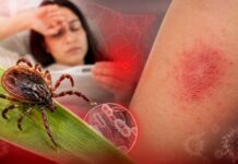 Guaymas, entre los municipios con más decesos por fiebre manchada en Sonora.