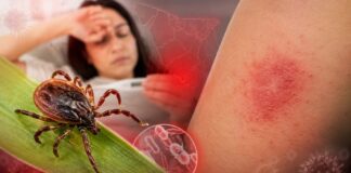 Guaymas, entre los municipios con más decesos por fiebre manchada en Sonora.